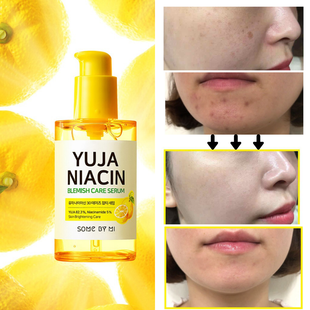 Yuja Niacin Blemish Care Serum - Imagen 2