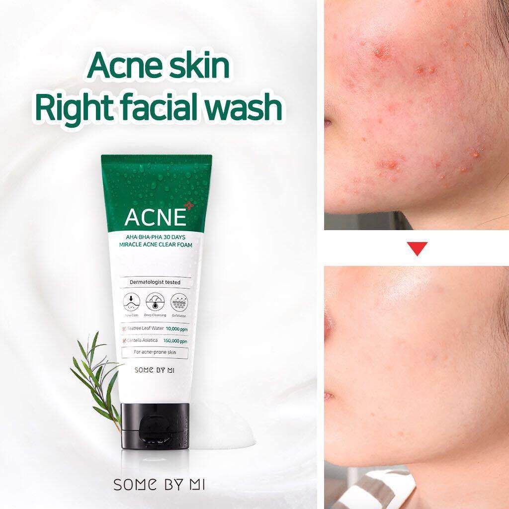 AHA BHA PHA 30 Days Miracle Acne Clear Foam - Imagen 2
