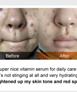 No. 5 Goodbye Blemish Serum - Imagen 3