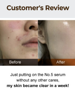 Alternative view of No. 5 Goodbye Blemish Serum