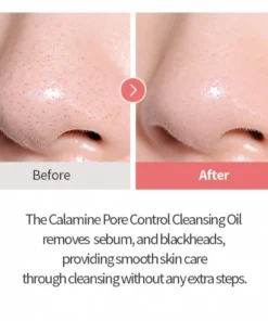 Alternative view of Calamine Pore Control Cleansing Oil