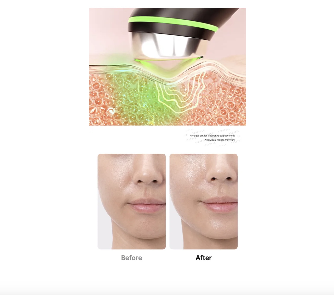 AGE-R Booster Pro - Imagen 7