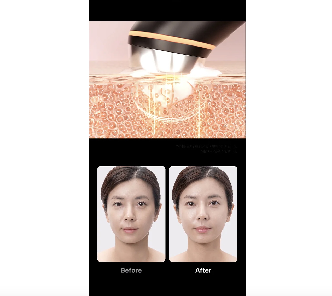 AGE-R Booster Pro - Imagen 5