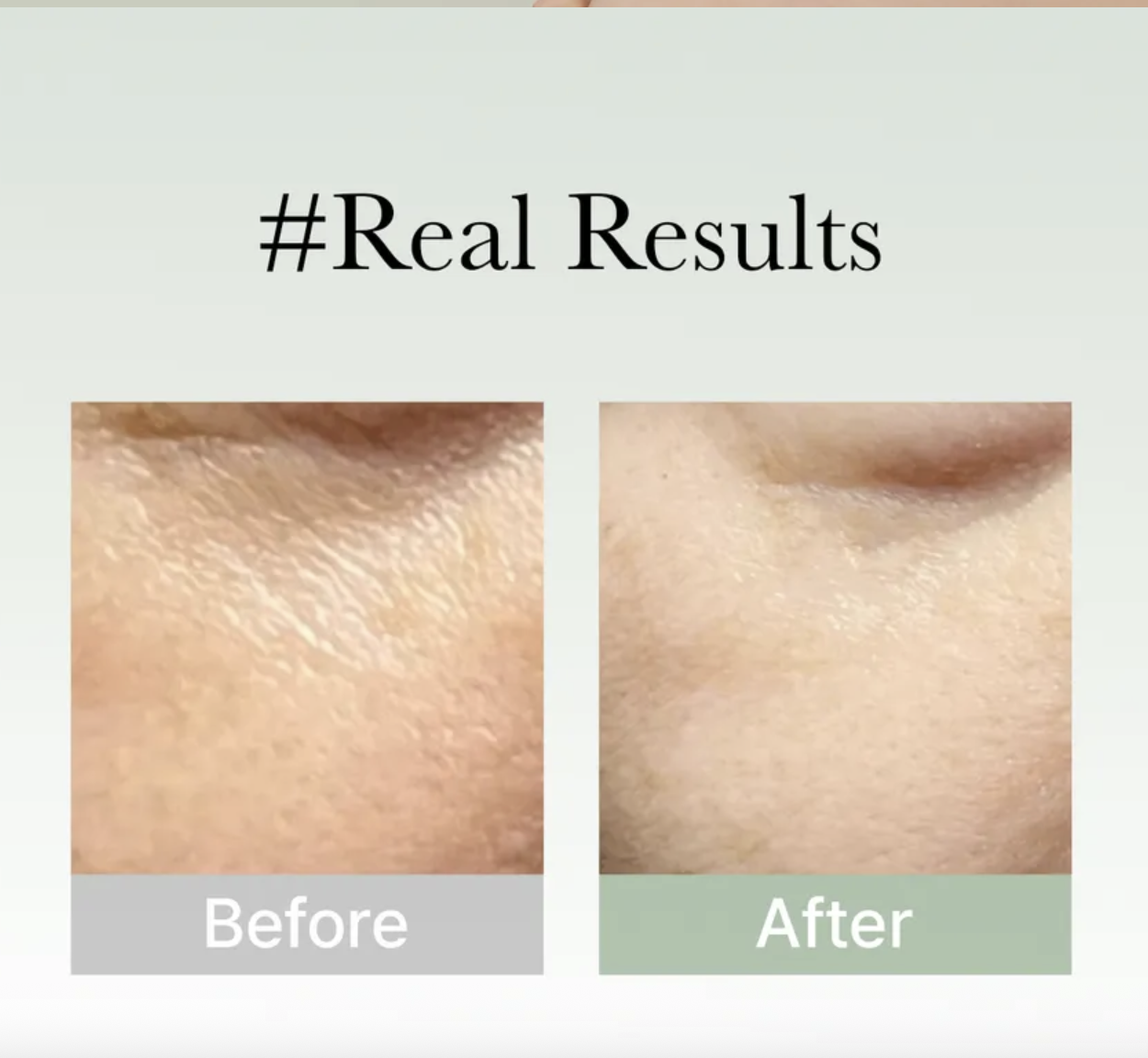 Holy Hyssop Serum 30 - Imagen 4