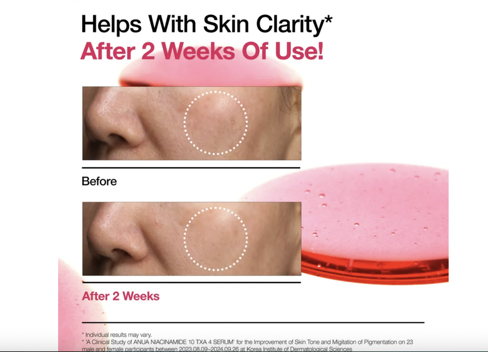 Niacinamide 10 % + TXA 4 % Serum - Imagen 5