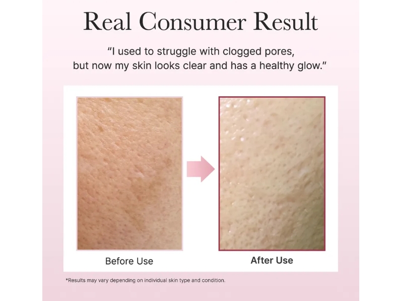 Fresh Rosehip Rice Mochi Cleanser - Imagen 4