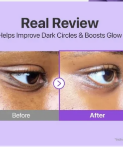 No.9 NAD+ Retinol Volumetox Eye Cream - Imagen 7