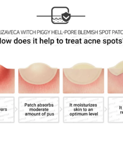 Witch Piggy Hell-Pore Blemish Spot Patch - Imagen 5